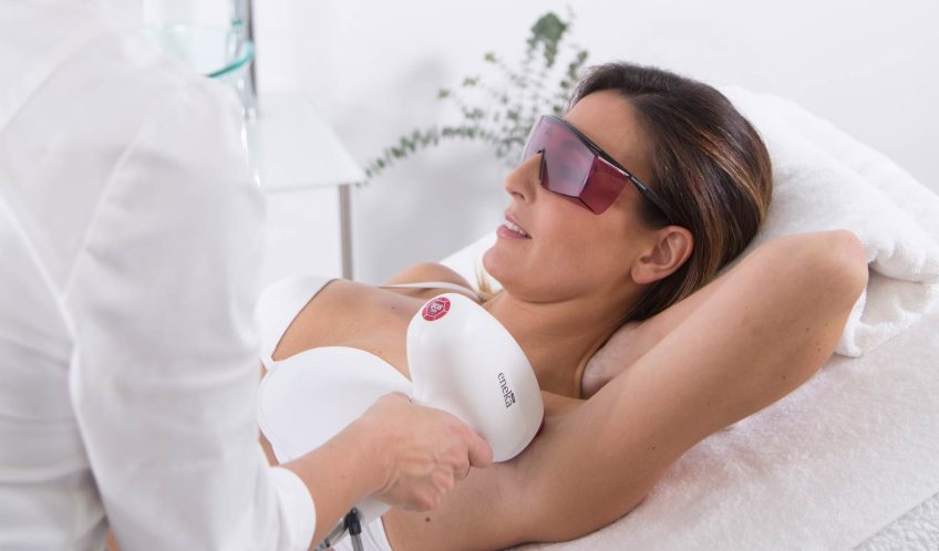 Is full body Laser Hair Removal worth it?